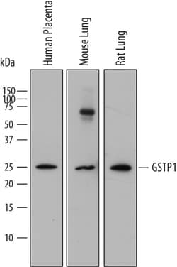Human Glutathione S-Transferase pi 1/GSTP1 Antibody, R D Systems 25&mu;g;