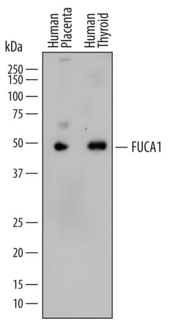 Human Tissue alpha-L-Fucosidase/FUCA1 Antibody, R D Systems 100ug; Unlabeled:Antibodies,