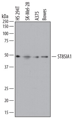 Human ST8 alpha-2,8-Sialyltransferase 8A/ST8SIA1 Antibody, R D Systems