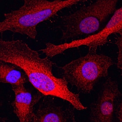 Human Glutathione S-Transferase pi 1/GSTP1 Antibody, R D Systems 25&mu;g;
