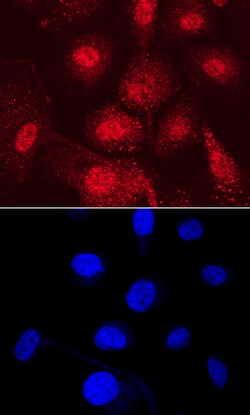 Human PDZD2 Antibody, R D Systems 100ug; Unlabeled:Antibodies, Monoclonal
