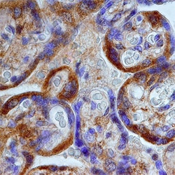 Human Perilipin-3 Antibody, R D Systems 100ug; Unlabeled:Antibodies, Monoclonal