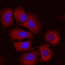 Human Semaphorin 3C Antibody, R D Systems 25&mu;g; Unlabeled:Antibodies,