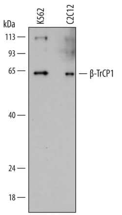 Human beta-TrCP1/BTRC Antibody, R D Systems 100ug; Unlabeled:Anticuerpos