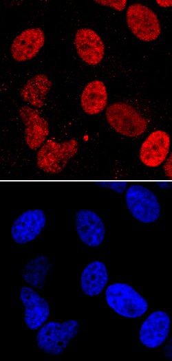 Human LEDGF Antibody, R D Systems 100ug; Unlabeled:Antibodies, Monoclonal