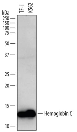 Human Hemoglobin zeta Antibody, R D Systems 25&mu;g; Unlabeled:Antibodies,