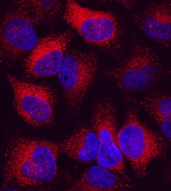 Human LMP2/PSMB9 Antibody, R D Systems 100ug; Unlabeled:Antibodies, Monoclonal