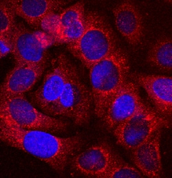 Human alpha 1-Microglobulin Antibody, R D Systems 100ug; Unlabeled:Anticorps,