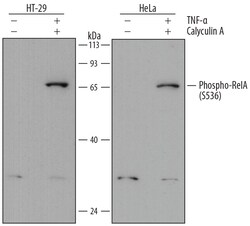 Human Phospho-RelA/NFkB p65 (S536) Antibody, R D Systems 100ug; Unlabeled:Anticorps,