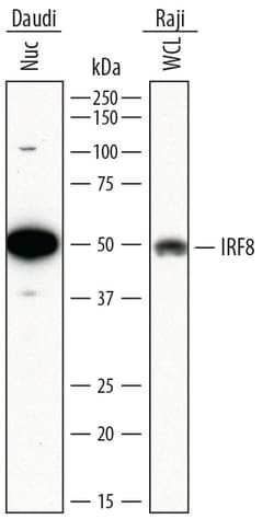 Human IRF8 Antibody, R D Systems 100ug; Unlabeled:Antibodies, Monoclonal