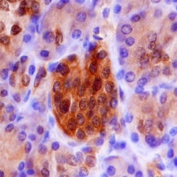Human Endophilin B1/B2 Antibody, R D Systems 25&mu;g; Unlabeled:Antibodies,