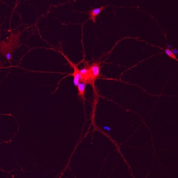 Human/Mouse/Rat Complexin-1/2 Antibody, R D Systems 25&mu;g; Unlabeled:Antibodies,