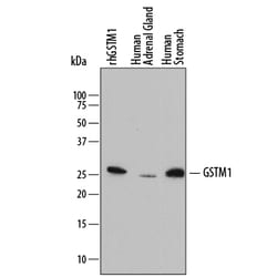 Human Glutathione S-Transferase mu 1/GSTM1 Antibody, R D Systems 25&mu;g;
