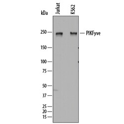 Human PIKFyve Antibody, R D Systems 25&mu;g; Unlabeled:Antibodies, Polyclonal