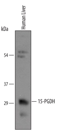Human 15-PGDH/HPGD Antibody, R D Systems 100&mu;g; Unlabeled:Antibodies,