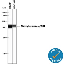 Human Glucosylceramidase/GBA Antibody, R D Systems 25&mu;g; Unlabeled:Antibodies,