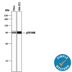 Human/Mouse/Rat p70 S6 Kinase Antibody, R D Systems 25&mu;g; Unlabeled:Antibodies,