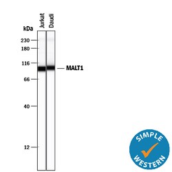 Human MALT1 Antibody, R D Systems 25&mu;g; Unlabeled:Antibodies, Monoclonal