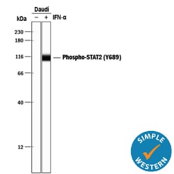 Human Phospho-STAT2 (Y689) Antibody, R D Systems 25 ug; Unconjugated:Antibodies,