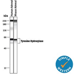 Human/Mouse Tyrosine Hydroxylase Antibody, R D Systems 25&mu;g; Unlabeled:Antibodies,