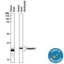 Human Troponin I/TNNI3 Antibody, R D Systems 100ug; Unlabeled:Antibodies