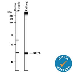 Human Glutathione S-Transferase pi 1/GSTP1 Antibody, R D Systems 25&mu;g;