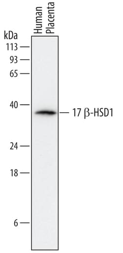 Human 17 beta-HSD1/HSD17B1 Antibody, R D Systems 25&mu;g; Unlabeled:Antibodies,
