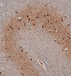 Human 17 beta-HSD14/HSD17B14 Antibody, R D Systems 100ug; Unlabeled:Antibodies,