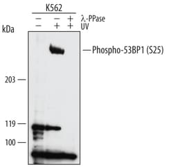 Human Phospho-53BP1 (S25) Antibody, R D Systems 25&mu;g; Unlabeled:Antibodies,