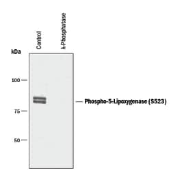 Human/Rat/Primate Phospho-5-Lipoxygenase (S523) Antibody, R D Systems 100&mu;L;