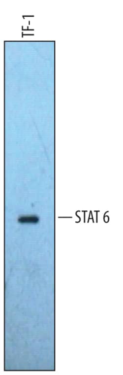 Human/Mouse STAT6 Antibody, R D Systems 200 &mu;L | Buy Online | R&D Systems | Fisher Scientific