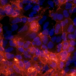 Human/Mouse/Rat/Chicken A2B5 Antibody, R D Systems 25&mu;g; Unlabeled:Antibodies,