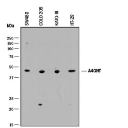 Human alpha-1,4-N-Acetylglucosaminyltransferase 4/A4GNT Antibody, R D Systems