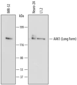 Human AAK1 Antibody, R D Systems 100ug; Unlabeled:Antibodies, Monoclonal