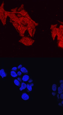 Human ABCA1 Antibody, R D Systems 25&mu;g; Unlabeled:Antibodies, Polyclonal