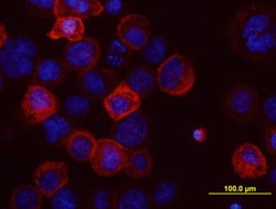 Human ABCG2 Antibody, R D Systems 100&mu;g:Antibodies, Monoclonal