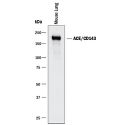 Mouse ACE/CD143 Antibody, R D Systems 100&mu;g; Unlabeled:Antibodies, Polyclonal
