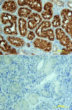 Human ACE/CD143 Antibody, R D Systems 25&mu;g; Unlabeled:Antibodies, Polyclonal