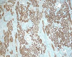 Human ACE/CD143 Antibody, R D Systems 25&mu;g; Unlabeled:Antibodies, Polyclonal