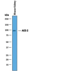ACE-2 Goat anti-Mouse, Polyclonal, R D Systems 25&mu;g; Unlabeled, Quantity: