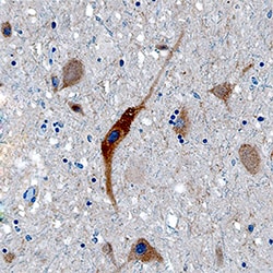 Human Acetylcholinesterase/ACHE Antibody, R D Systems:Antibodies:Primary