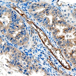 Human ACP6 Antibody, R D Systems 25&mu;g; Unlabeled:Antibodies, Polyclonal
