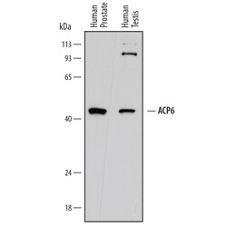 Human ACP6 Antibody, R D Systems 25&mu;g; Unlabeled:Antibodies, Polyclonal