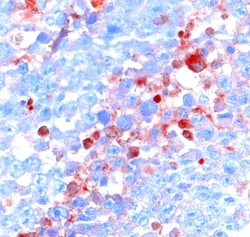 Human Activin RIA/ALK-2 Antibody, R D Systems 100&mu;g; Unlabeled:Antibodies,