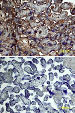 Human Activin RIA/ALK-2 Antibody, R D Systems 100&mu;g; Unlabeled:Antibodies,