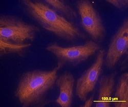 Human Activin RIA/ALK-2 Antibody, R D Systems:Antibodies:Primary Antibodies