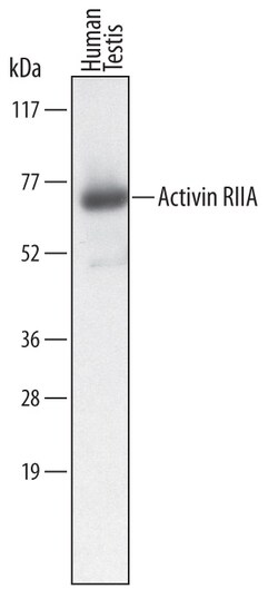 Human Activin RIIA Antibody, R D Systems 500ug; Unlabeled:Antibodies, Monoclonal