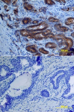 Human ADAM15 Ectodomain Biotinylated Antibody, R D Systems 50&mu;g; Biotin:Antibodies,