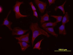 Human ADAM15 Ectodomain Antibody, R D Systems 100&mu;g:Antibodies, Monoclonal