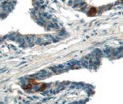 Human ADAM15 Ectodomain Antibody, R D Systems 100&mu;g:Antibodies, Monoclonal